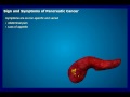 Pancreatic Cancer Sign and Symptoms